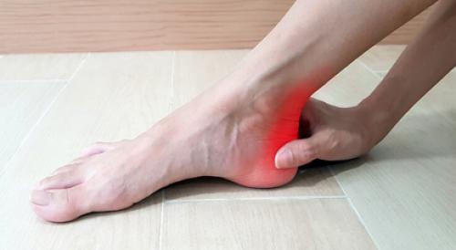 Insertional Achilles Tendinopathy